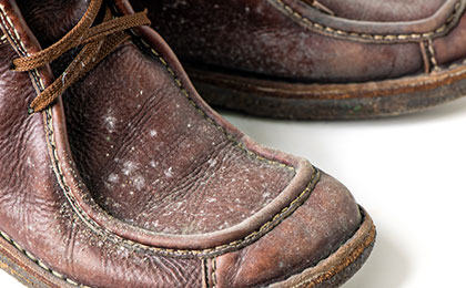 Mold on Shoes in Closet: Causes, Cleaning Methods, and Prevention Tips Mold on Shoes in Closet: Causes, Cleaning Methods, and Prevention Tips